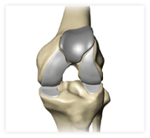patellofemoral knee