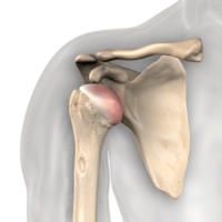 shoulder-pain-shoulder-dislocation